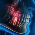 How to treat teeth pain